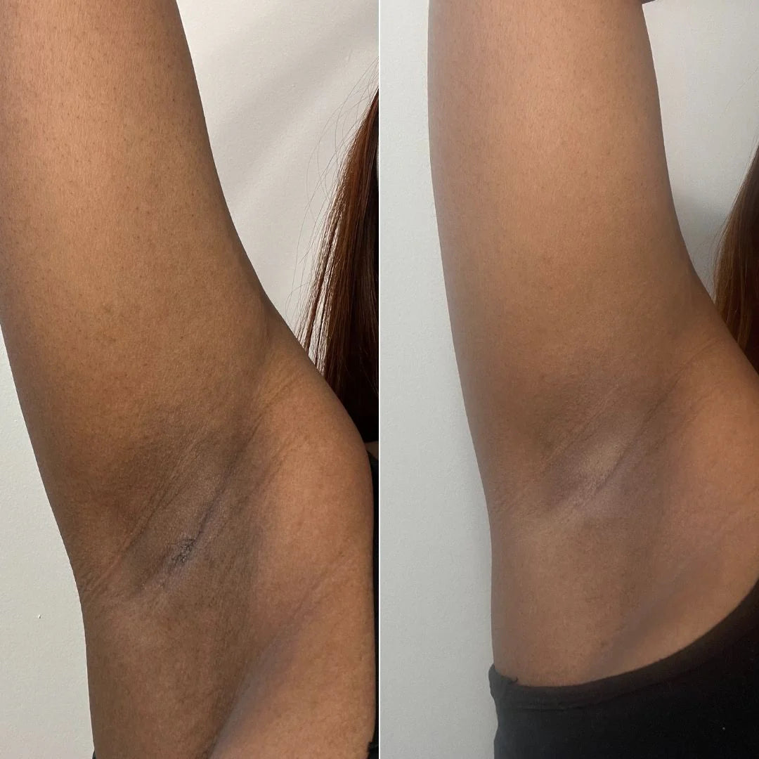 Meeko™ Turmeric & Kojic acid Soap