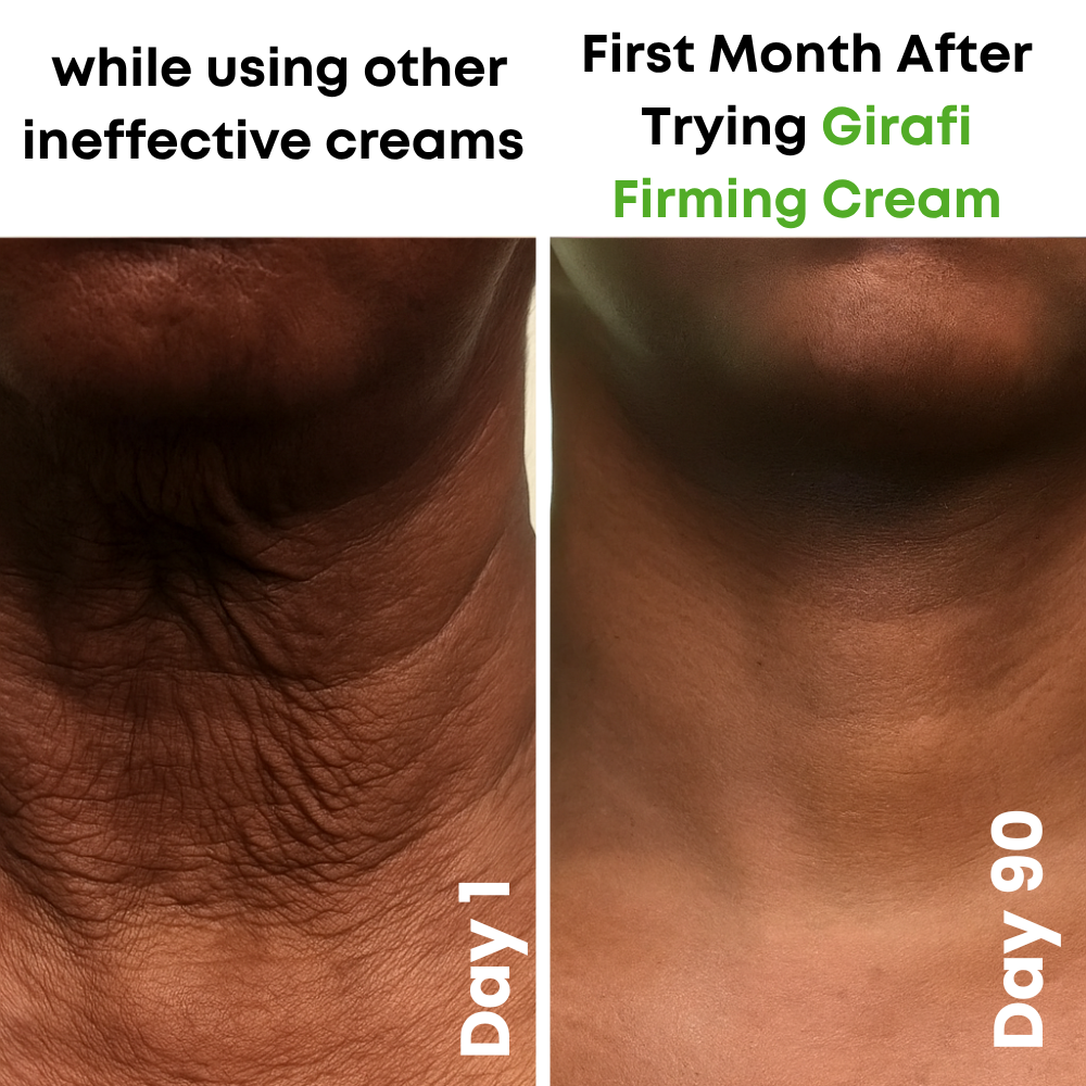 Girafi™ AH-8 Neck Firming Cream