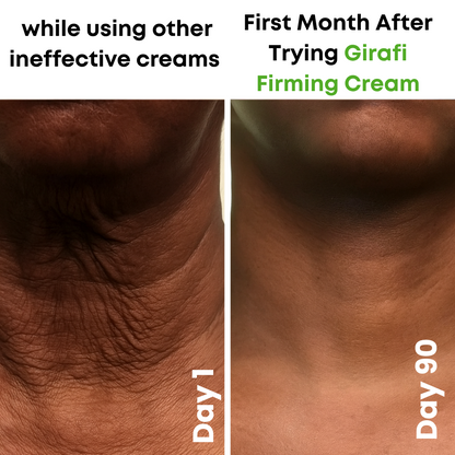 Girafi™ AH-8 Neck Firming Cream