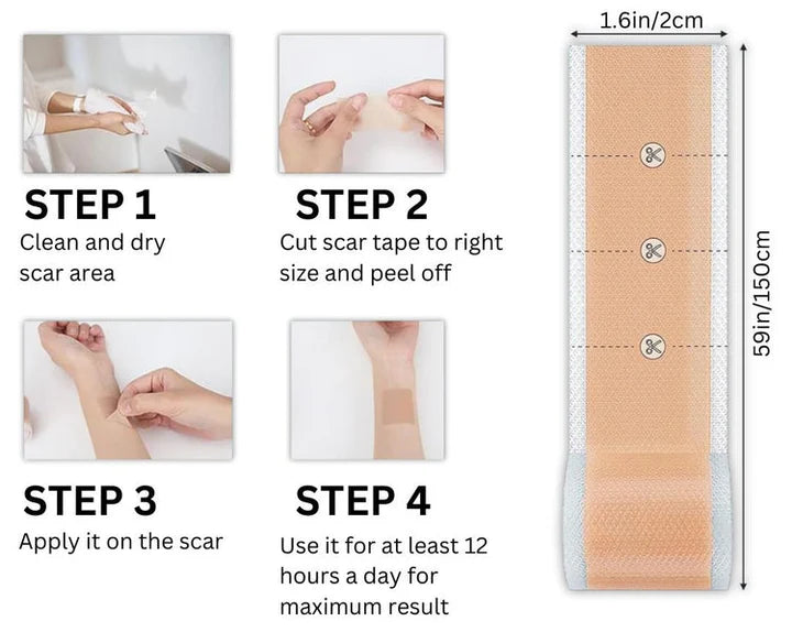 ScarEase™ Collagen Recovery Tape