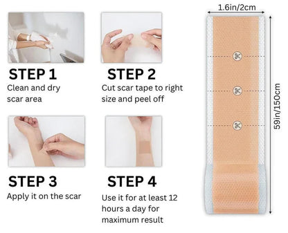 ScarEase™ Collagen Recovery Tape